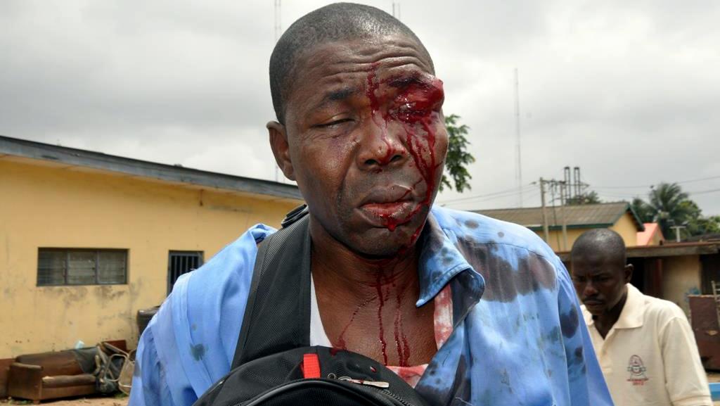 Impunity in journalist killings muzzles press