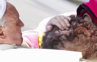 Pope Francis' embrace of a severely disfigured man touches world