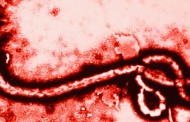 Ebola diagnosed in U.S. for the first time