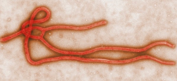 2nd US hospital worker to contract Ebola identified
