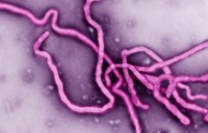 Second possible Ebola case in the US reported in Texas