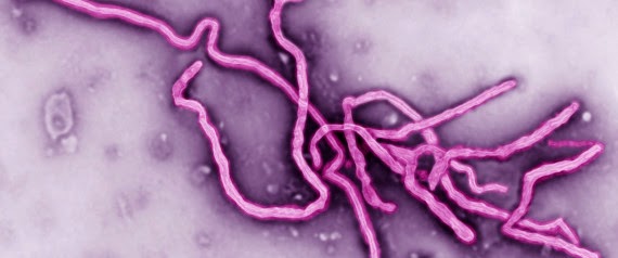 Second possible Ebola case in the US reported in Texas