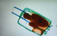 Ivorian child smuggled to Spain in suitcase