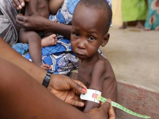 Child malnutrition is on the rise in Nigeria despite concerted efforts by government, UNICEF and other development partners #stopchildmalnutritionnigeria