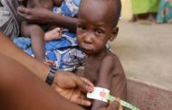 Malnutrition, ravaging killer in Nigeria #stopchildmalnutritionnigeria